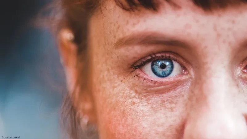 How Does Blue Light Affect the Skin?