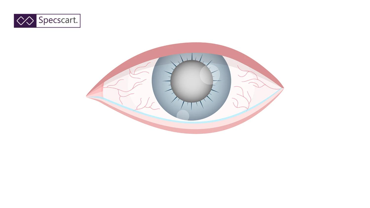 Ultimate Guide to Glaucoma: Causes, Symptoms and Treatment