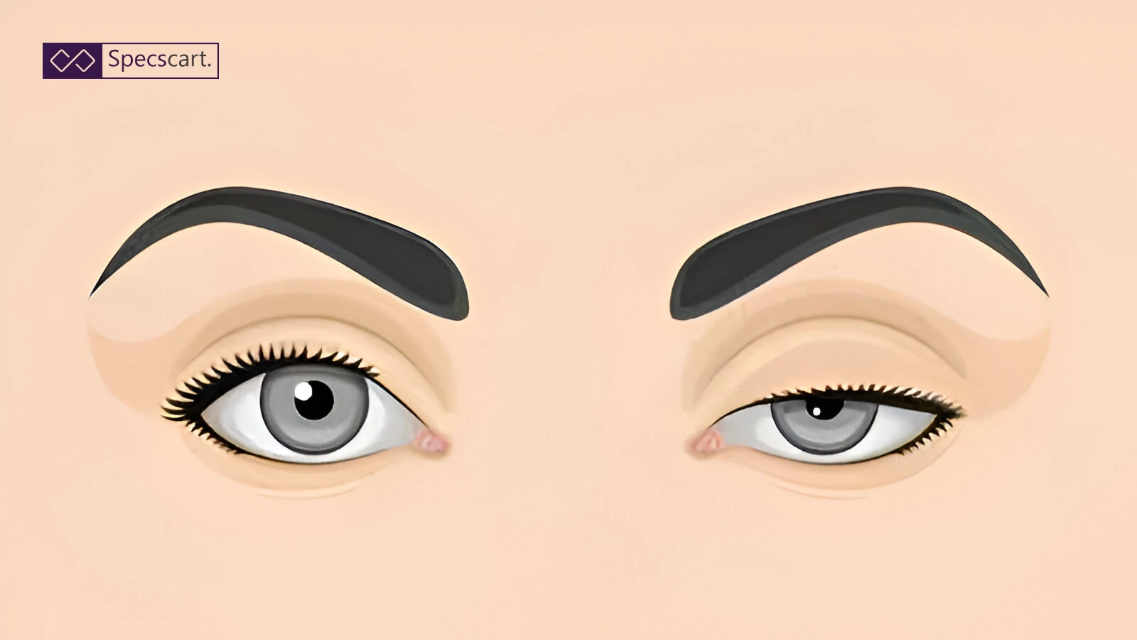 Ptosis: Everything You Need to Know About Eyelid Drooping