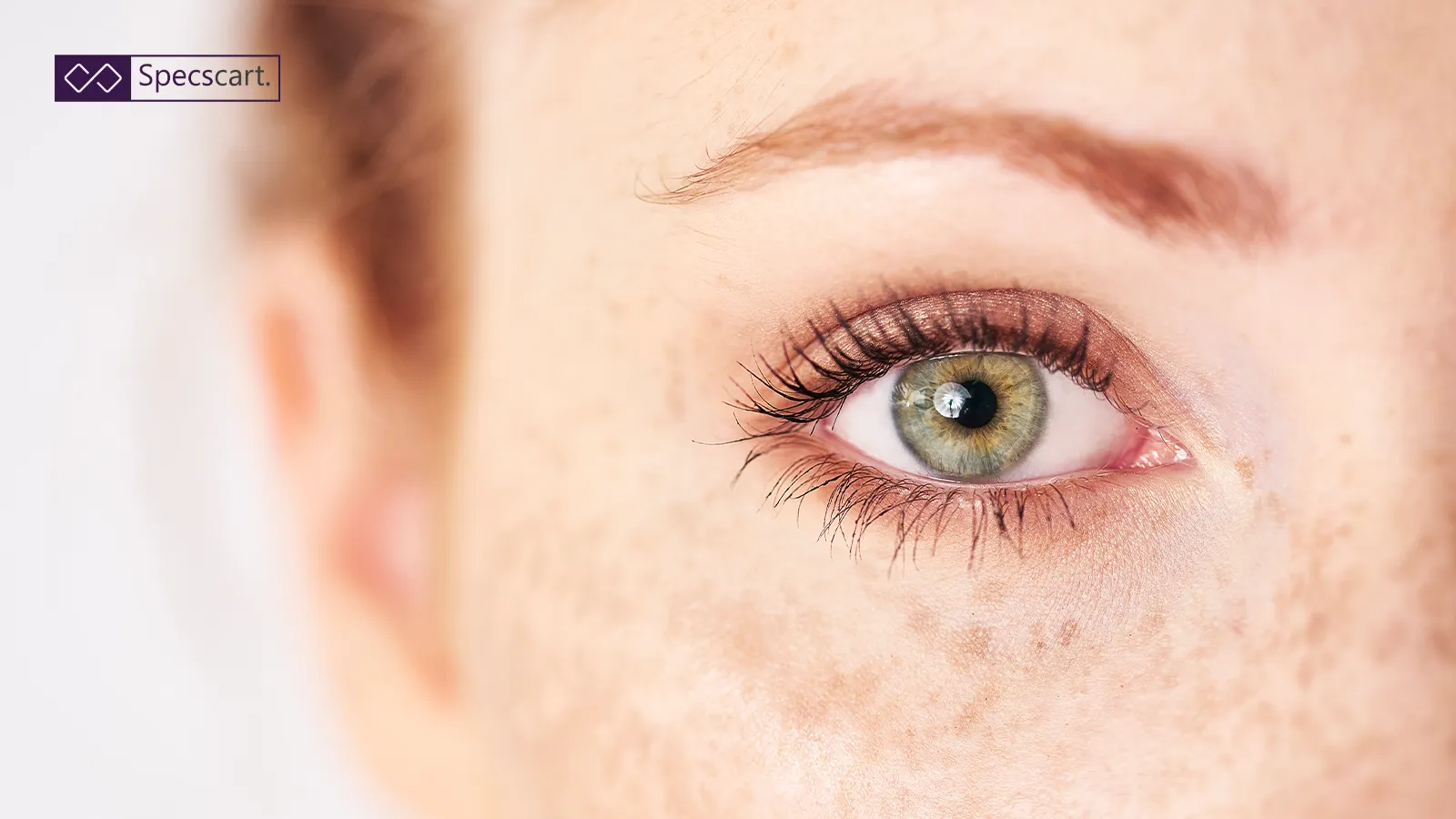 Close-up of a light green eye with a small brown spot on the iris, surrounded by facial freckles, illustrating a common eye freckle.