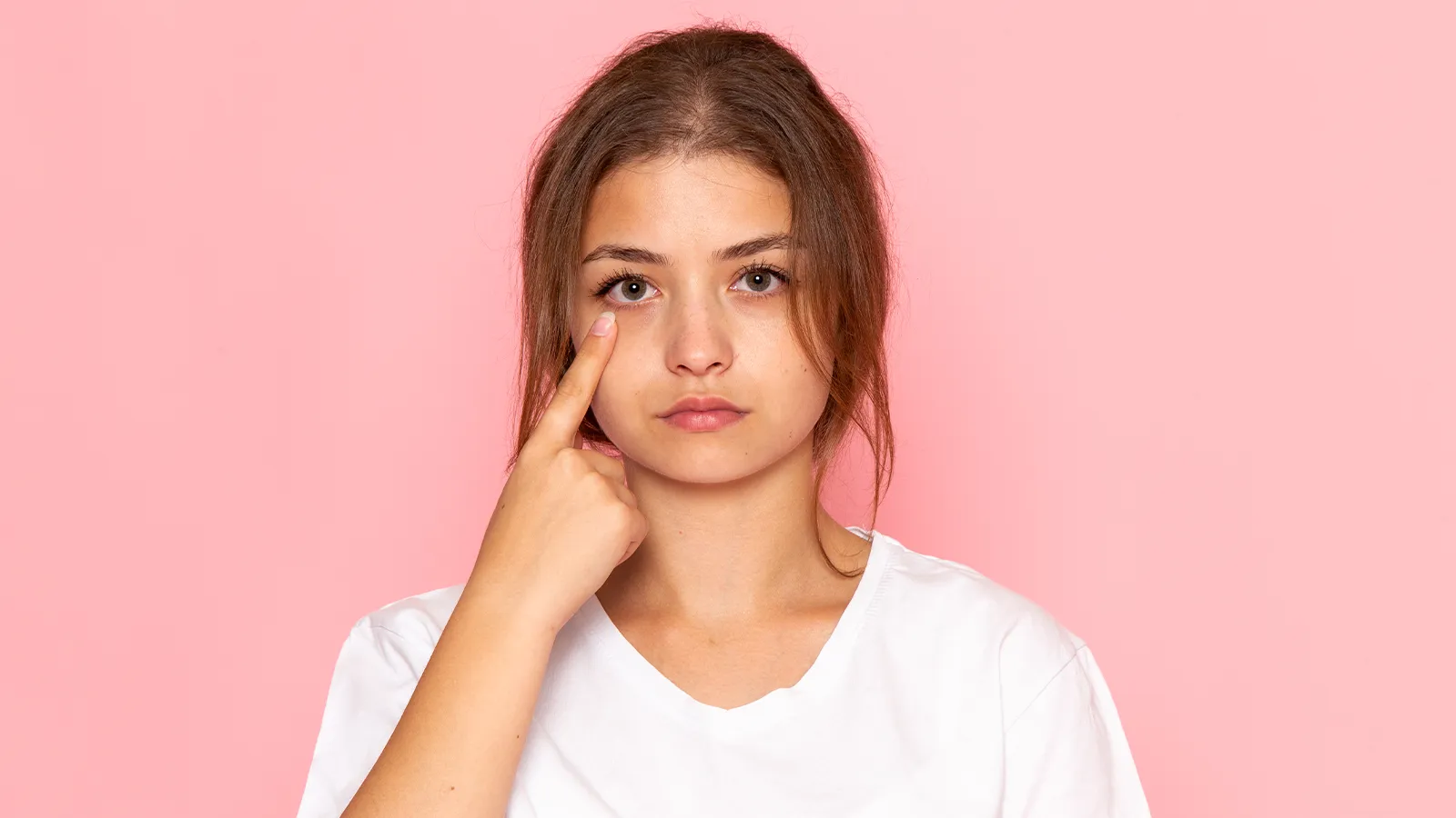 A young woman looks seriously at the camera, pointing to the delicate skin directly under her eye, highlighting the issue of potential dark circles.