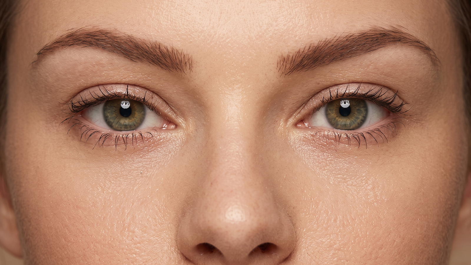 Upturned eyes