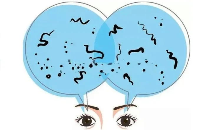What are eye floaters? How to reduce floaters in eyes naturally? Illustration of eyes looking through blue circles filled with black squiggles and dots representing floaters.